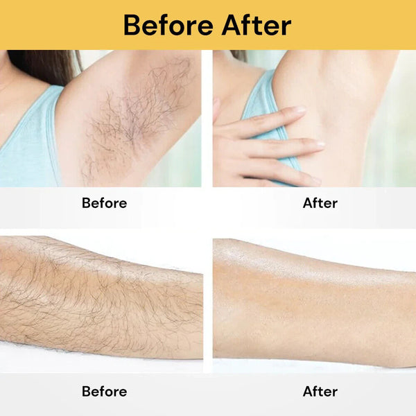 900000 Flashes Laser Epilator Permanent IPL Photoepilator Laser Hair Removal AUS