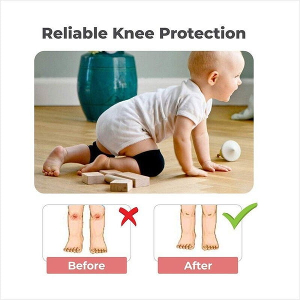 Baby Crawling Knee Pads – Soft Safety Protector Leg Warmers