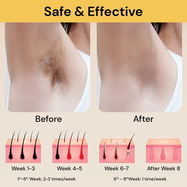 900000 Flashes Laser Epilator Permanent IPL Photoepilator Laser Hair Removal AUS