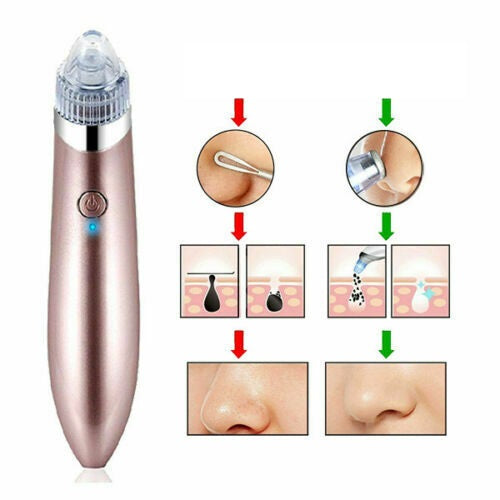 Facial Skin Care Pore Blackhead Remover Cleaner+ USB Charge Vacuum Acne Cleanser - Lets Party