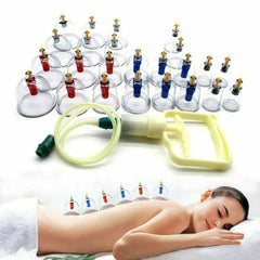 24 Cups Vacuum Cupping Set Massage Kit Acupuncture Suction Massager Pain Relief