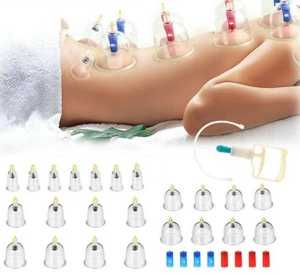 24 Cups Vacuum Cupping Set Massage Kit Acupuncture Suction Massager Pain Relief - Lets Party