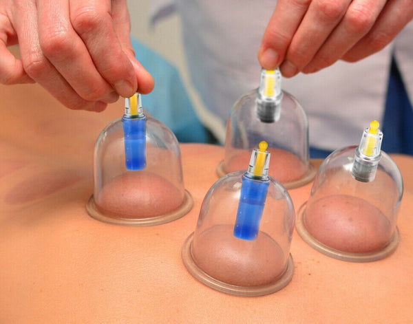 24 Cups Vacuum Cupping Set Massage Kit Acupuncture Suction Massager Pain Relief - Lets Party