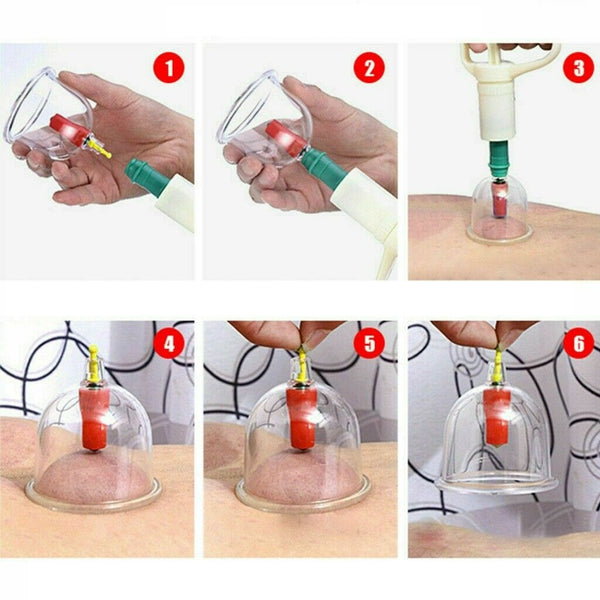 24 Cups Vacuum Cupping Set Massage Kit Acupuncture Suction Massager Pain Relief - Lets Party