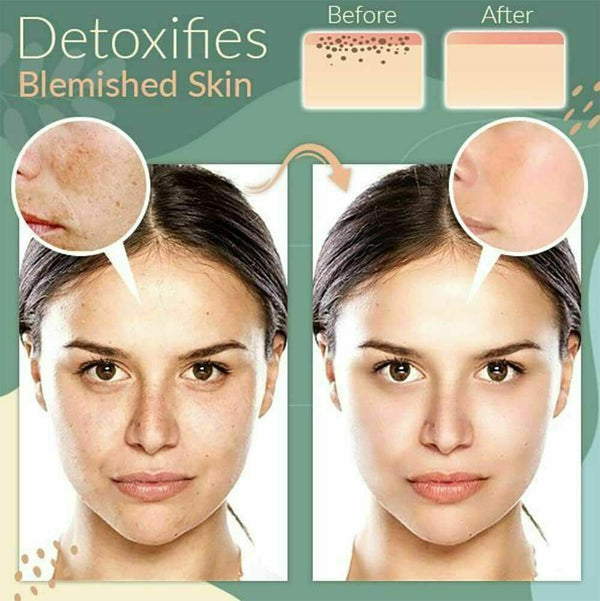 1x Green Tea Cleansing Mask Facial Stick Oil Acne Control Blackhead Deep Clean - Lets Party