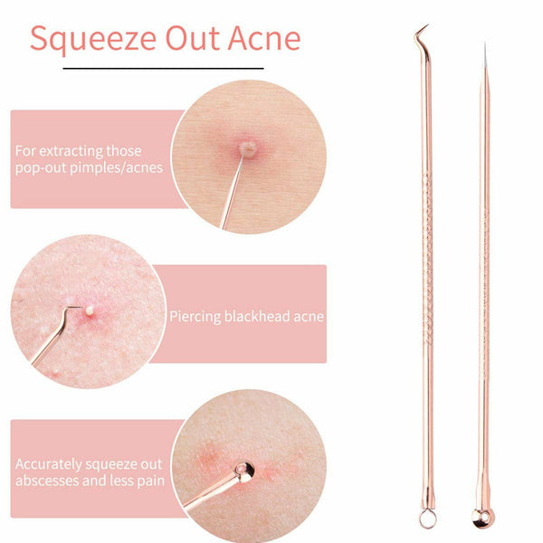 Blackhead Pimple Remover Tool Popper Extractor Black Head Tools Set Stainless