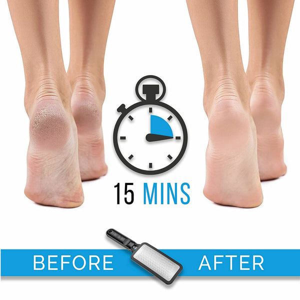 RoseRed Stainless Steel Foot File Scraper Grater Pedicure Rasp Callus Remover Tool - Lets Party