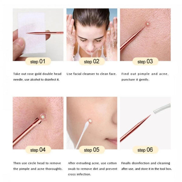 4pc Blackhead Remover Propper Tool Pimple Pore Blemish Comedone Acne Cleaner Kit