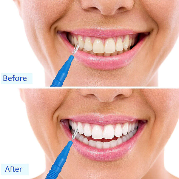 60pcs Interdental Brush Floss Sticks Tooth Floss Head Toothpick Cleaning New AU