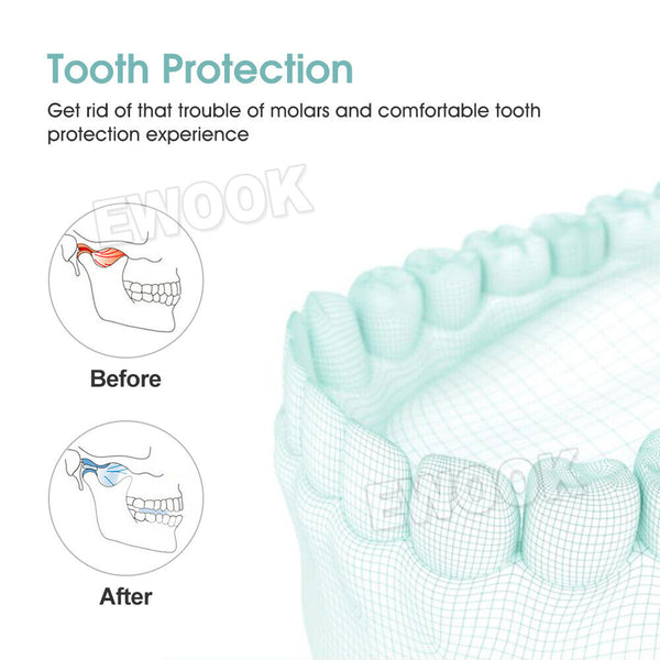 Teeth Protector Dental Mouth Night Guard Tooth Grinding Bruxism Grind Sleep - Lets Party