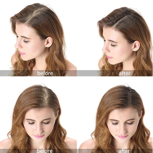 Dark Brown Hair Loss Building Fibers 27.5g Alopecia Keratin Thicker Concealer - Lets Party