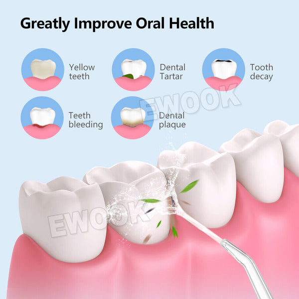 Cordless Oral Irrigator Water Jet Dental Teeth Flosser Tooth Cleaner 4 Nozzles - Lets Party