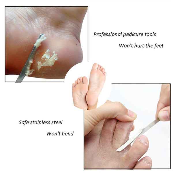 Stainless Steel Foot Pedicure Knife Callus Dead Skin Remover Scraper Tool Scrapi