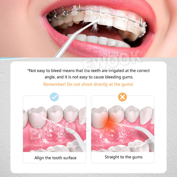 Cordless Oral Irrigator Water Jet Dental Teeth Flosser Tooth Cleaner 4 Nozzles - Lets Party