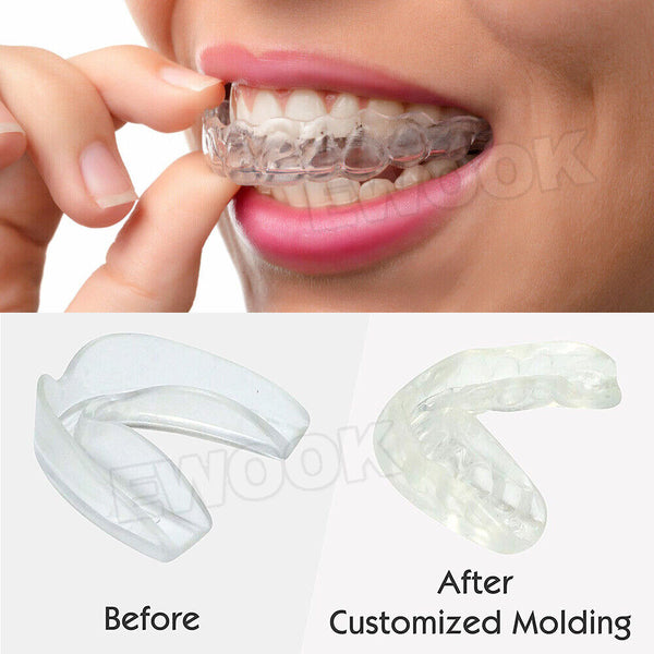 4x Teeth Grinding Mouthguard Mouth Guard Night Bruxism Clenching Sleeping Dental - Lets Party