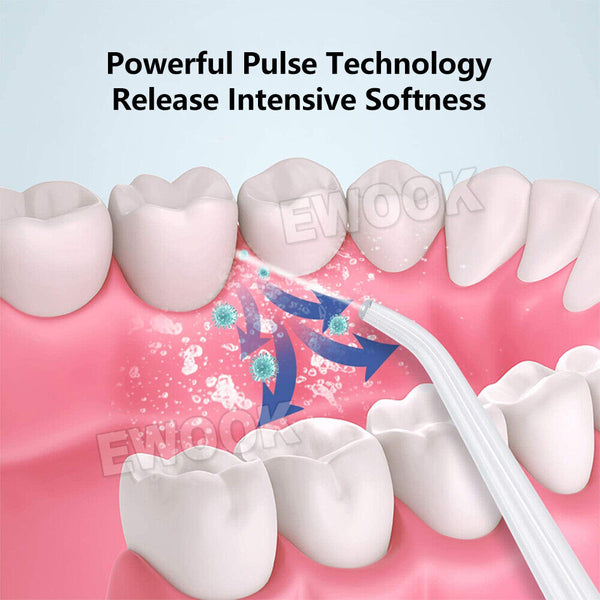 Cordless Oral Irrigator Water Jet Dental Teeth Flosser Tooth Cleaner 4 Nozzles - Lets Party