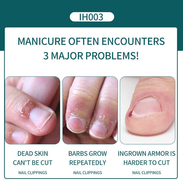 Nail Clippers for Thick Nails Toe Finger Best Large Sharp Cuticle Nipper Catcher