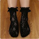 Women Lady Girls Ankle Fancy Fairy Retro Lace Ruffle frilly princess Short Socks