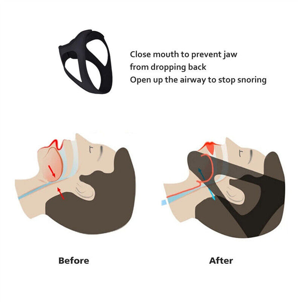 New Stop Snoring Chin Strap Anti Snore Sleep Apnea Belt Device Solutions Jaw AU