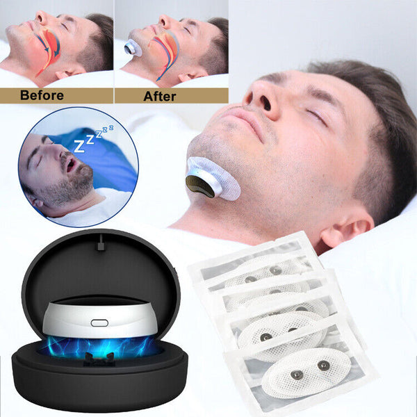 Anti Snoring Device Micro Sleep Apnea Electric Stop Snore Aid Stopper CPAP Noise