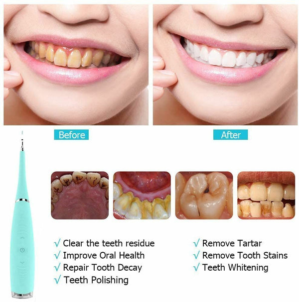 Electric Dental Scale Tartar Calculus Plaque Remover Tooth Stains Cleaning Tool