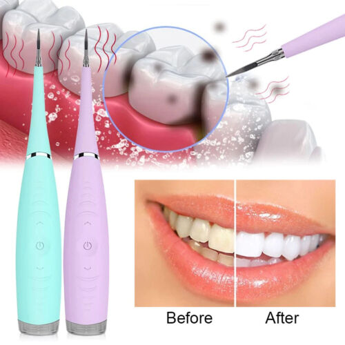 Electric Dental Scale Tartar Calculus Plaque Remover Tooth Stains Cleaning Tool