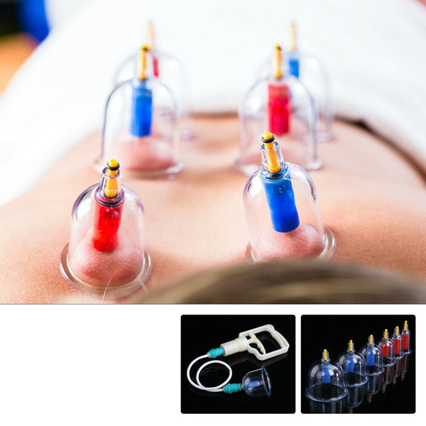 24 Cups Vacuum Cupping Set Massage Kit Acupuncture Suction Massager Pain Relief - Lets Party