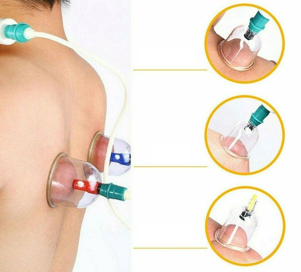 24 Cups Vacuum Cupping Set Massage Kit Acupuncture Suction Massager Pain Relief - Lets Party