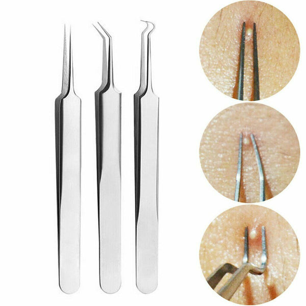 9 pcs Set Kit Blackhead Whitehead Acne Pimple Popper Extractor Remover Tools - Lets Party