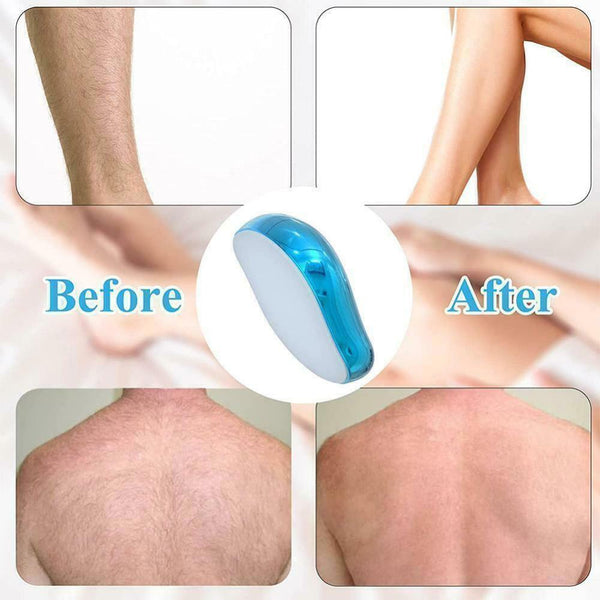 Gold Painless Physical Hair Removal Epilators Crystal Hair Eraser for Women Men - Lets Party