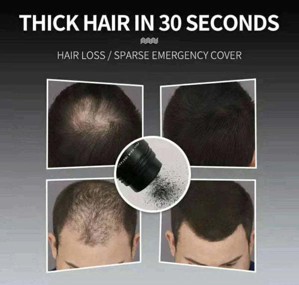 Dark Brown Hair Loss Building Fibers 27.5g Alopecia Keratin Thicker Concealer - Lets Party