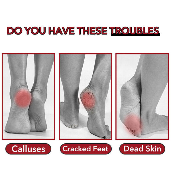 Foot Care Pedicure Callus Shaver Hard Skin Remover Wood Handle 10 Blades AUS