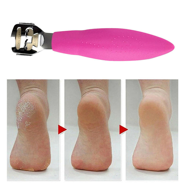 Foot File Hard Skin Remover Callus Shaver Corn Cutter Pedicure Tool + 10 Blades - Lets Party