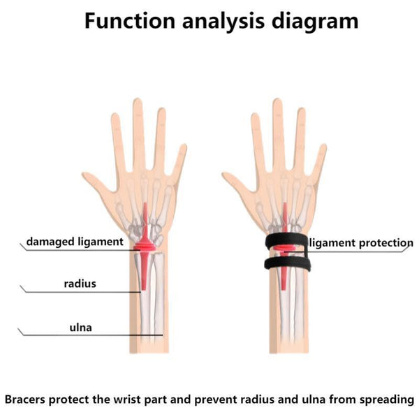 2PCS Wrist Band Ulnar Fix Sports Yoga TFCC Tear Sprain Protection Pain Injury AU