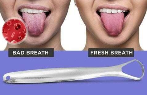 Stainless Steel Tongue Tounge Cleaner Scraper Dental Care Oral Hygiene Mouth Kit - Lets Party